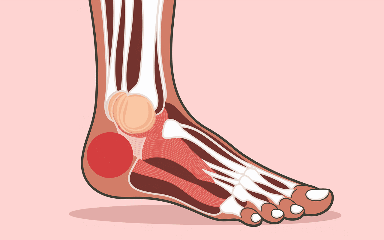 Oeil de perdrix huiles essentielles pied coupe zone rouge